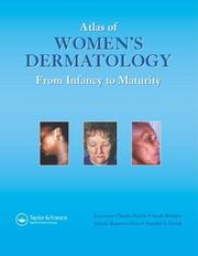 Atlas of women's dermatology : from infancy to maturity Lawrence Charles Parish ....